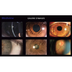 Lampe à fente biomicroscope à focalisation motorisée sortie HDMI