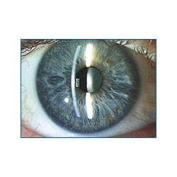 Lampe à fente type Haag Streit à cinq grossissement LED nouveau modèle