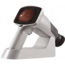 Rétinographe non-mydriatique portable sans fil haute résolution