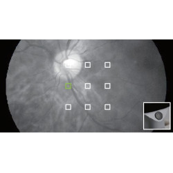 Rétinographe non-mydriatique portable sans fil haute résolution