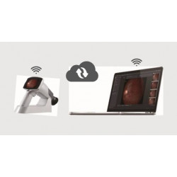 Rétinographe non-mydriatique portable sans fil haute résolution