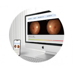 Location Rétinographe non-mydriatique binoculaire automatique