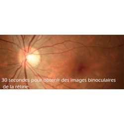 Location Rétinographe non-mydriatique binoculaire automatique