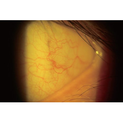 location Lampe à fente trois grossissements type Zeiss LED platine métal