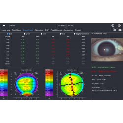 Topographe cornéen DEA 520 TOPOGRAPHE SEUL