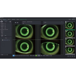 Aide à l'ajustement des lentilles d'orthokératologie
